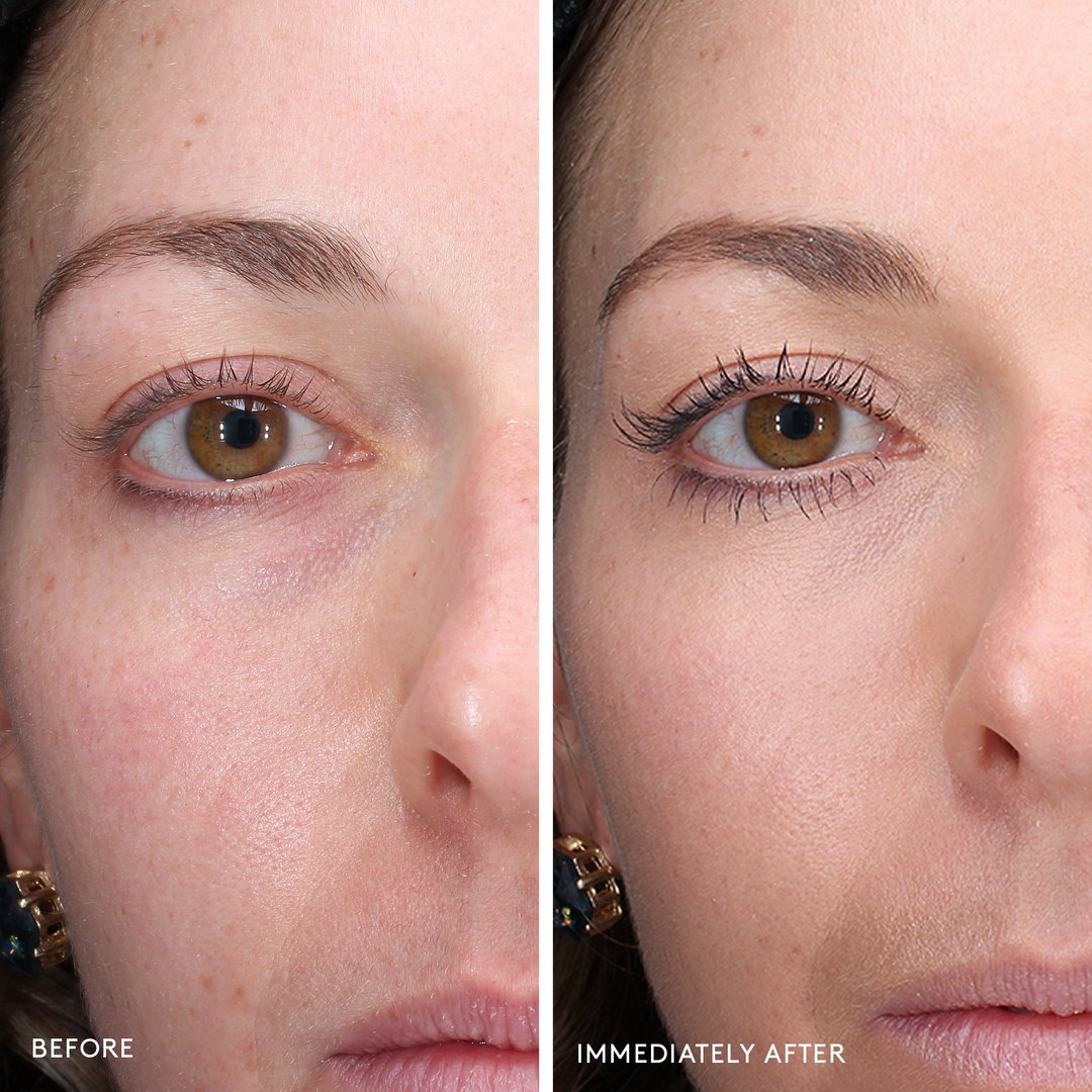 Colorescience® Total Eye™ 3-IN-1 Renewal Therapy SPF 35